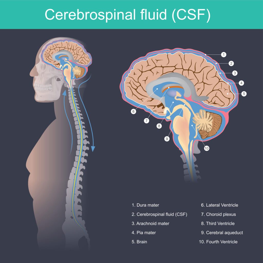 Lesión cerebral ferroviaria