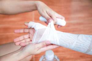 What Compensation Can I Recover for a Burn Injury Under FELA?